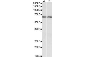 Image no. 1 for anti-Acetylcholinesterase (AChE) (C-Term) antibody (ABIN185357)