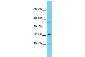 Image no. 1 for anti-Ribosomal Protein L23A (RPL23A) (C-Term) antibody (ABIN2776693)