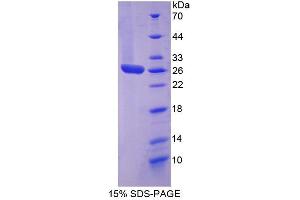 Image no. 1 for Signal Transducer and Activator of Transcription 3 (Acute-Phase Response Factor) (STAT3) (AA 335-546) protein (His tag) (ABIN6238625)