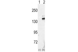 Image no. 3 for anti-Ret Proto-Oncogene (RET) (AA 1012-1042) antibody (ABIN3032460)