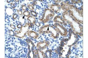 Image no. 1 for anti-Protein L-Myc (MYCL) (AA 135-184) antibody (ABIN202065)