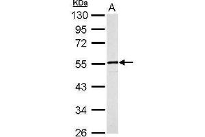 Image no. 5 for anti-Desmin (DES) (Center) antibody (ABIN2855655)