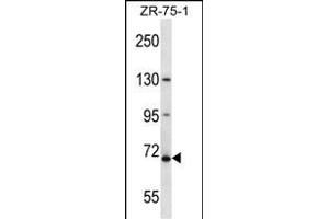 ZNF135 抗体  (N-Term)