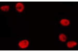 Image no. 1 for anti-Peroxisome Proliferator-Activated Receptor gamma (PPARG) (N-Term) antibody (ABIN6254905)