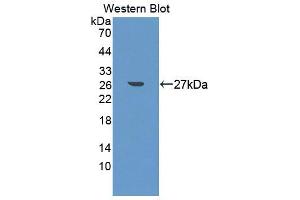 Image no. 1 for anti-YY1 Associated Factor 2 (YAF2) (AA 1-180) antibody (ABIN5014546)