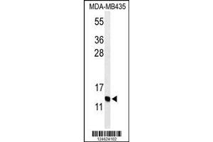 Image no. 1 for anti-Gonadotropin-Releasing Hormone 2 (GnRH2) (AA 26-53) antibody (ABIN653741)