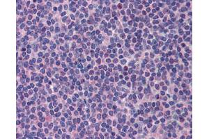 Image no. 1 for anti-Promyelocytic Leukemia (PML) (C-Term) antibody (ABIN2777721)