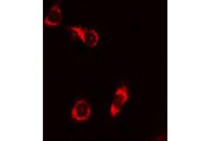 Image no. 2 for anti-BCL2-Associated Agonist of Cell Death (BAD) (pSer155) antibody (ABIN6256155)