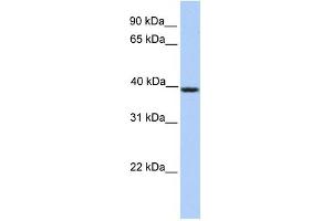 Image no. 1 for anti-serpin Peptidase Inhibitor, Clade A (Alpha-1 Antiproteinase, Antitrypsin), Member 5 (SERPINA5) (C-Term) antibody (ABIN2785441)