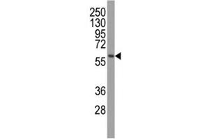 Image no. 5 for anti-PTEN Induced Putative Kinase 1 (PINK1) antibody (ABIN3032404)