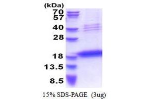 Image no. 1 for Leukocyte Cell Derived Chemotaxin 1 (LECT1) (AA 214-334) protein (His tag) (ABIN5853498)