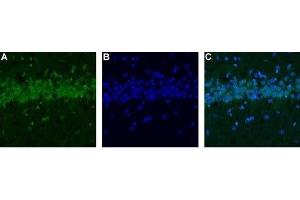Expression of CALHM1 in rat hippocampus - Immunohistochemical staining of rat hippocampus using Anti-CALHM1 Antibody (ABIN7043013, ABIN7044044 and ABIN7044045).