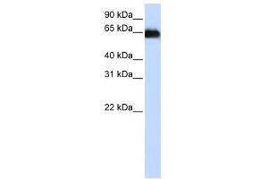 Image no. 1 for anti-ADAM Metallopeptidase Domain 12 (ADAM12) antibody (ABIN634632)