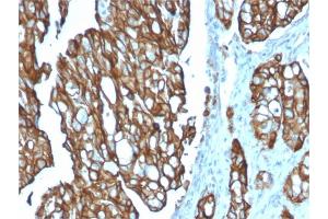 Image no. 3 for anti-Tumor-Associated Calcium Signal Transducer 2 (TACSTD2) (AA 31-274) antibody (ABIN6939971)