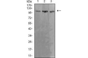 Image no. 1 for anti-Adenosine Deaminase, RNA-Specific (ADAR) (AA 1085-1223) antibody (ABIN5611213)