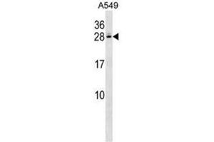Image no. 1 for anti-Complement Component 4 Binding Protein, beta (C4BPB) (AA 124-153), (Middle Region) antibody (ABIN950920)