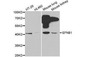 Image no. 1 for anti-Ephrin B1 (EFNB1) antibody (ABIN1679663)