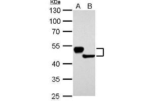 Image no. 1 for anti-Keratin 13 (KRT13) (Center) antibody (ABIN2856711)