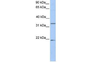 Image no. 1 for anti-Fucosyltransferase 6 (Alpha (1,3) Fucosyltransferase) (FUT6) (C-Term) antibody (ABIN633952)
