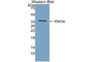 Image no. 1 for anti-Connective Tissue Growth Factor (CTGF) (AA 25-348) antibody (ABIN1077951)