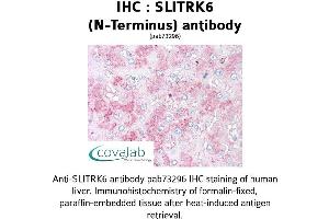 Image no. 1 for anti-SLIT and NTRK-Like Family, Member 6 (SLITRK6) (N-Term) antibody (ABIN1739443)