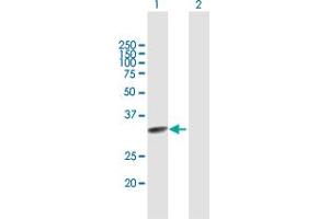 anti-Transcription Elongation Factor A (SII)-Like 2 (TCEAL2) (AA 1-227) antibody