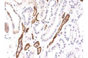 Image no. 1 for anti-Complement Component C4b (C4b) antibody (ABIN5575828)