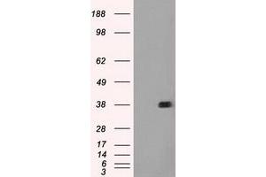 Image no. 3 for anti-Fc gamma RII (CD32) antibody (ABIN1497257)