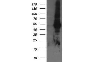 Image no. 11 for anti-TAP Binding Protein-Like (TAPBPL) antibody (ABIN1501300)