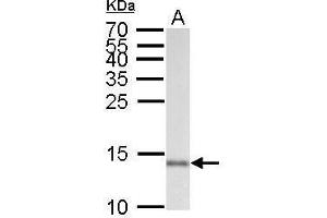 Image no. 8 for anti-Allograft Inflammatory Factor 1 (AIF1) (C-Term) antibody (ABIN2857032)