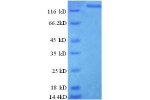 Image no. 1 for Ligase I, DNA, ATP-Dependent (LIG1) (AA 1-919), (full length) protein (GST tag) (ABIN5709861)