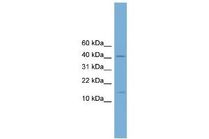 Image no. 1 for anti-Pre-B-Cell Leukemia Homeobox 4 (PBX4) (N-Term) antibody (ABIN2780077)