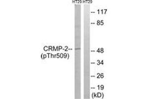 Image no. 1 for anti-Dihydropyrimidinase-Like 2 (DPYSL2) (AA 475-524), (pThr509) antibody (ABIN1532136)