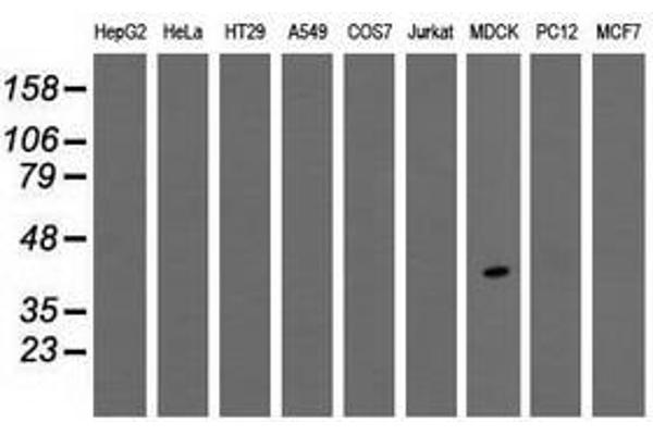TPMT antibody