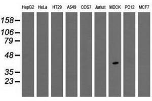 Image no. 6 for anti-Thiopurine S-Methyltransferase (TPMT) antibody (ABIN1501480)
