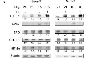Image no. 3 for anti-Endothelial PAS Domain Protein 1 (EPAS1) (Center) antibody (ABIN2855683)