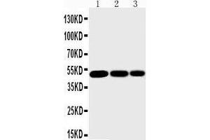Image no. 1 for anti-Inhibitor of kappa Light Polypeptide Gene Enhancer in B-Cells, Kinase gamma (IKBKG) (AA 1-15), (N-Term) antibody (ABIN3042676)