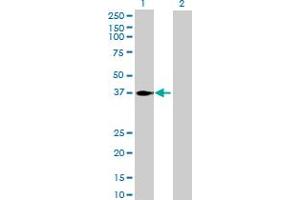Image no. 1 for anti-COP9 Signalosome Complex Subunit 6 (COPS6) (AA 1-327) antibody (ABIN524371)