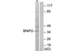 Image no. 1 for anti-BCL2/adenovirus E1B 19kDa Interacting Protein 2 (BNIP2) (AA 265-314) antibody (ABIN1534684)