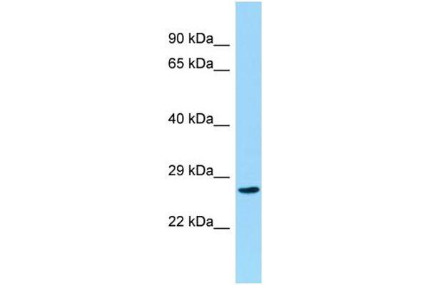 CCDC28B 抗体  (C-Term)
