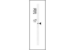 Urm1 anticorps