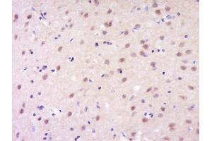 Image no. 2 for anti-Goosecoid Homeobox (GSC) (AA 151-257) antibody (ABIN1714193)