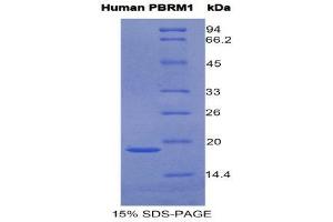 Image no. 1 for Polybromo 1 (PBRM1) (AA 1152-1273) protein (His tag) (ABIN1877691)
