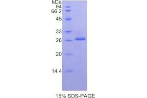 Image no. 1 for Prostate Specific Antigen (PSA) protein (ABIN3010301)