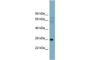 Image no. 1 for anti-Dystroglycan 1 (DAG1) (Middle Region) antibody (ABIN2782634)
