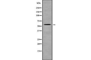 Image no. 1 for anti-Solute Carrier Family 22 (Organic Cation Transporter), Member 17 (SLC22A17) (C-Term) antibody (ABIN6265112)