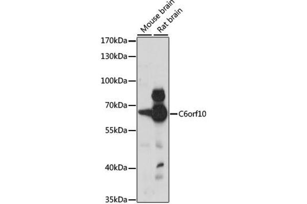 anti-CDNA Sequence BC051142 (BC051142) antibody