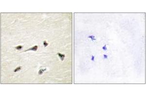 Image no. 1 for anti-A Kinase (PRKA) Anchor Protein 12 (AKAP12) (AA 301-350) antibody (ABIN1533824)