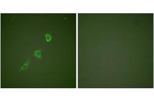 Image no. 3 for anti-Heat Shock 10kDa Protein 1 (Chaperonin 10) (HSPE1) (AA 51-100) antibody (ABIN1533310)
