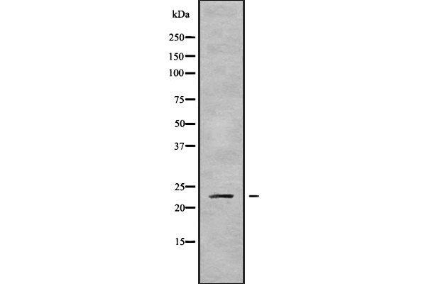 RAB43 antibody  (Internal Region)